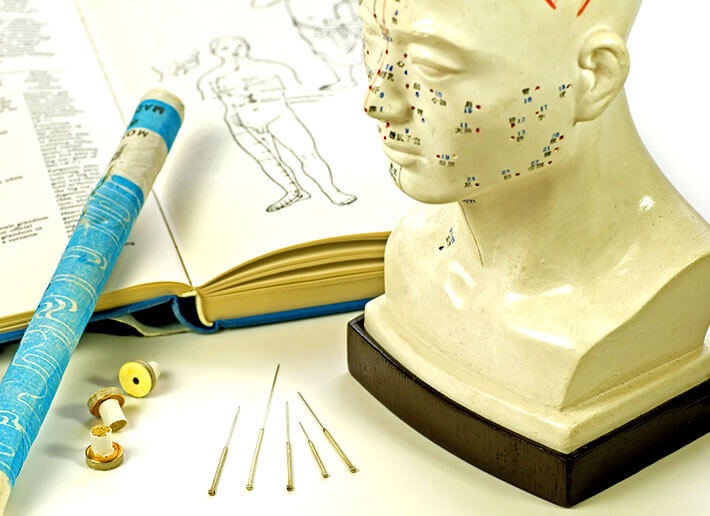 Acupuncture.